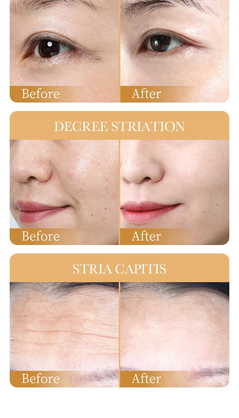 10PCS Collagen Facial Mask – Anti-Wrinkle, Anti-Aging, Moisturizing & Brightening Korean Skincare - Foshkan.com