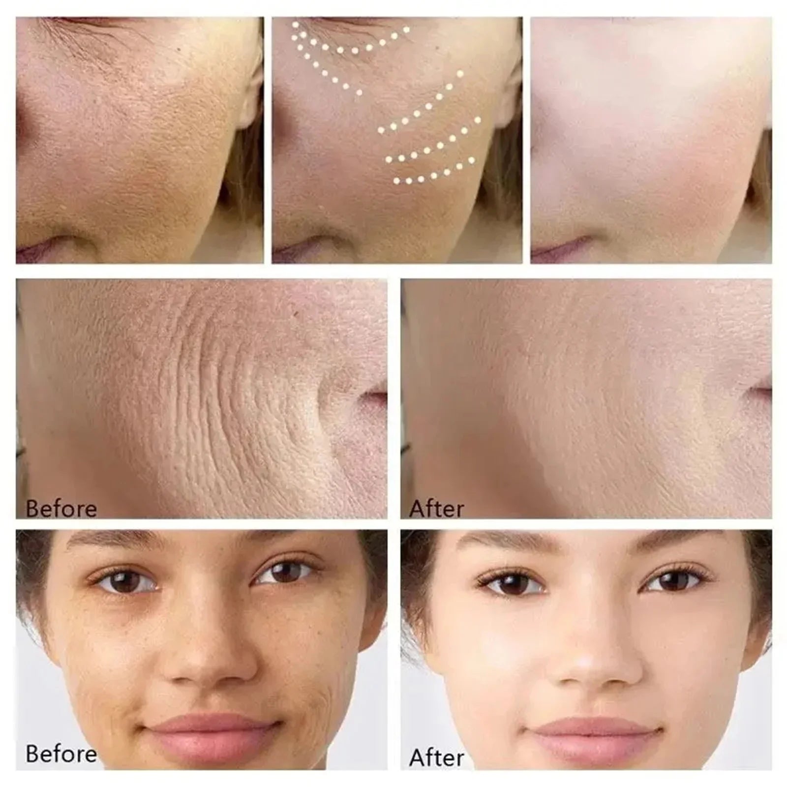 1/3/5/10PCS Bio Collagen Face Mask – Anti-Wrinkle, Firming & Brightening Korean Skincare for Fine Lines & Anti-Aging - Foshkan.com